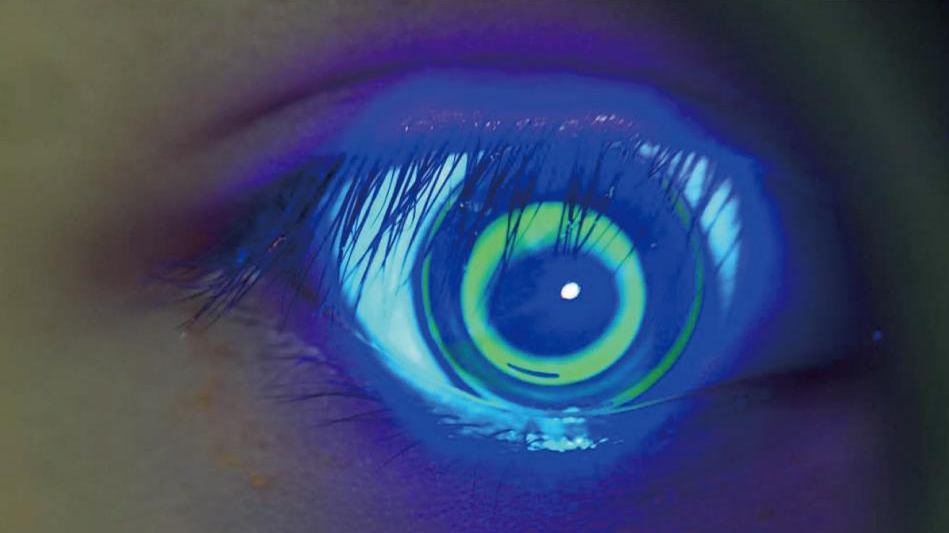 眼科检查仪器叫什么【眼科检查】眼科放大镜——裂隙灯生物显微镜到底查什么？_https://www.jmylbn.com_新闻资讯_第36张