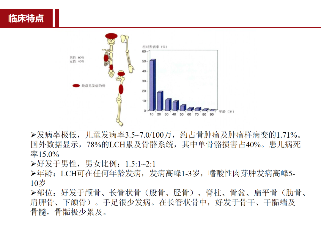 朗格汉斯细胞组织细胞增多症，一种儿童罕见骨病，本文给你讲清楚了！