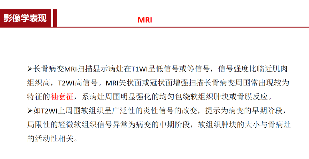 朗格汉斯细胞组织细胞增多症，一种儿童罕见骨病，本文给你讲清楚了！