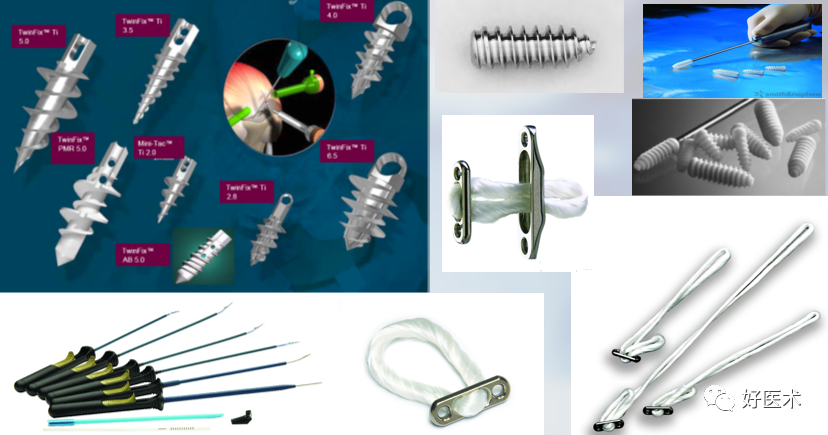 关节镜配套哪些关节镜技术速成诀窍_https://www.jmylbn.com_新闻资讯_第31张