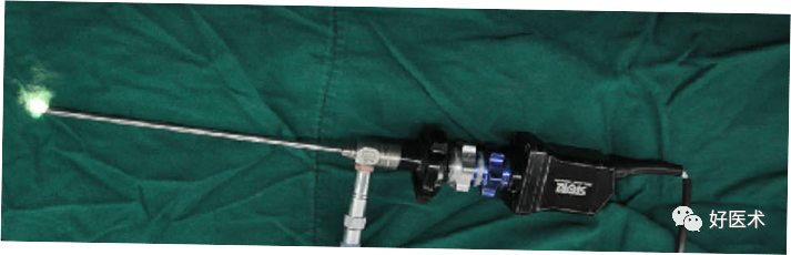 关节镜配套哪些关节镜技术速成诀窍_https://www.jmylbn.com_新闻资讯_第2张