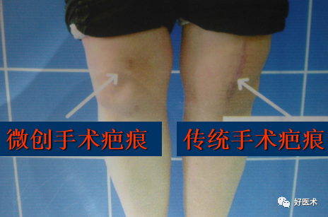 关节镜配套哪些关节镜技术速成诀窍_https://www.jmylbn.com_新闻资讯_第38张