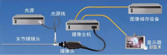 关节镜配套哪些关节镜技术速成诀窍_https://www.jmylbn.com_新闻资讯_第5张