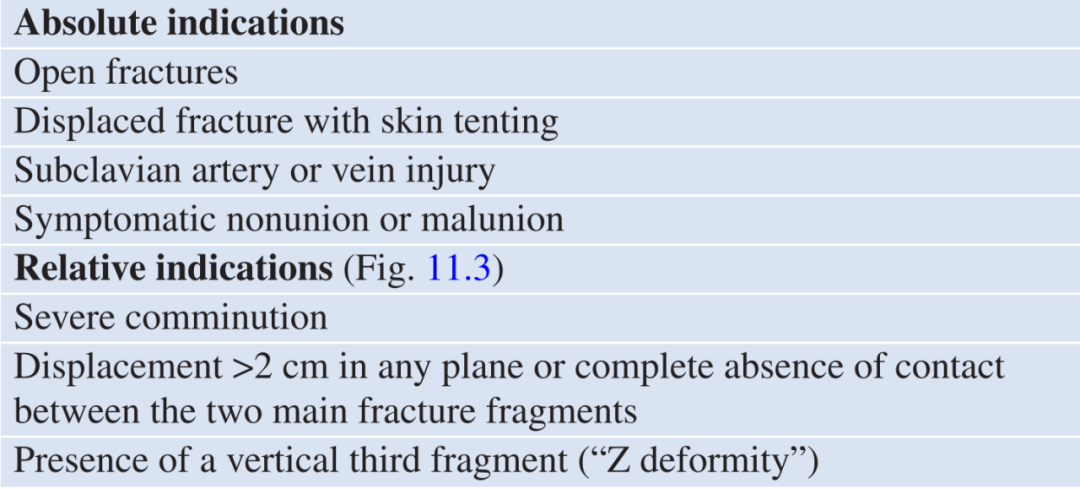 基于Robinson分类法，详解锁骨骨折的分型与治疗