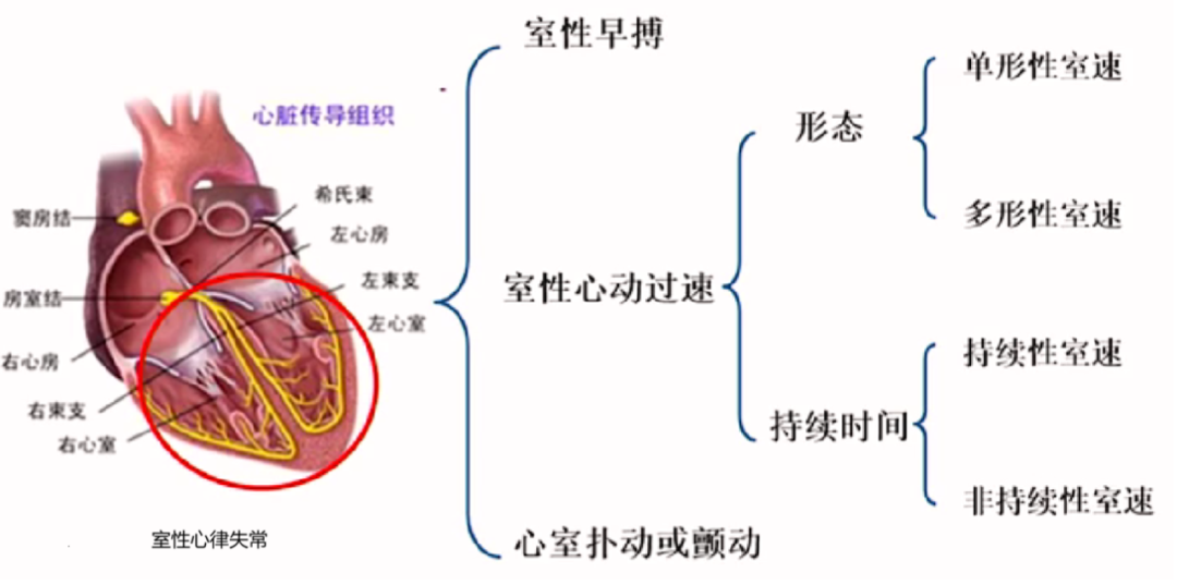 心律解码丨室性心律失常药物选用难？看完这份处理策略就好了！