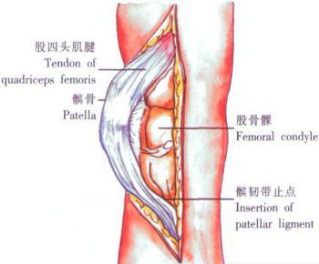 ​给你整理好了！人工膝关节置换手术步骤全解