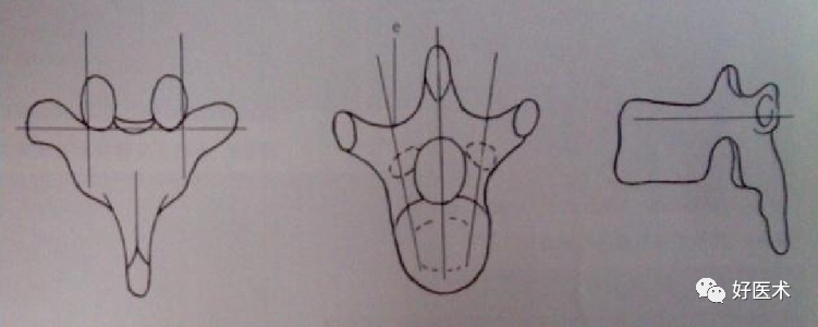颈、胸、腰椎椎弓根钉置钉技巧，必备高清图解（全）！