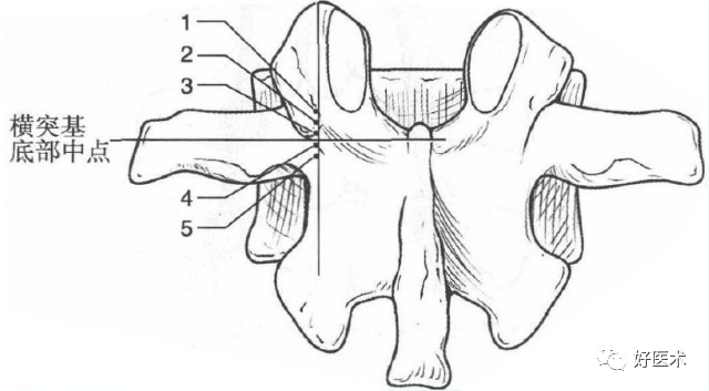 颈、胸、腰椎椎弓根钉置钉技巧，必备高清图解（全）！