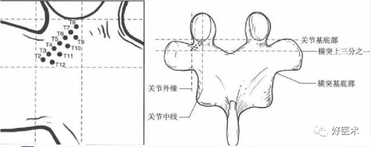 颈、胸、腰椎椎弓根钉置钉技巧，必备高清图解（全）！