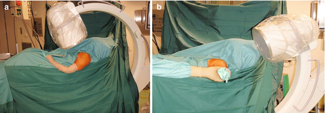 图文详解：肱骨大结节骨折的关节镜治疗