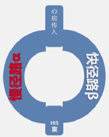 心律解码丨房室结折返性心动过速的心电图特点与机制