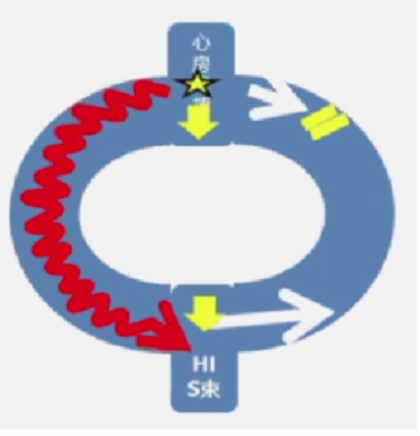 心律解码丨房室结折返性心动过速的心电图特点与机制
