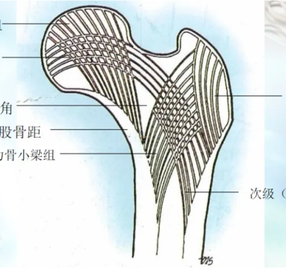 粗隆下骨折，如何巧妙使用“阻挡钉”？