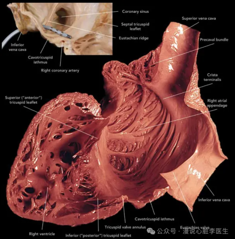 心律解码丨心房扑动的心电图特点及治疗