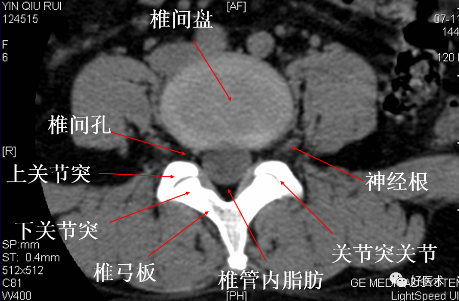 脊柱影像解剖及诊断要点_医学界-助力医生临床决策和职业成长