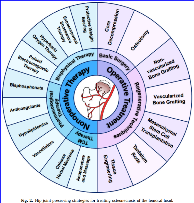 股骨头坏死保髋治疗的现状与最新进展