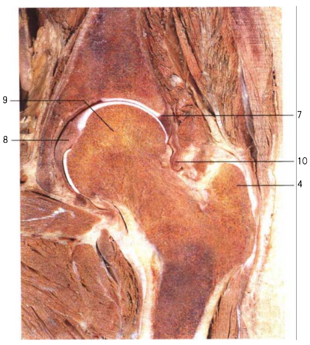 关于股骨颈骨折，你了解多少，这篇实用干货给你准备好了！