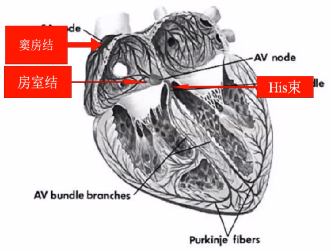 心律解码丨急诊心律失常的诊断及处理