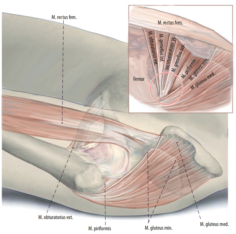 图文并茂：股骨翻修手术中的直接前入路（DAA）技术详解