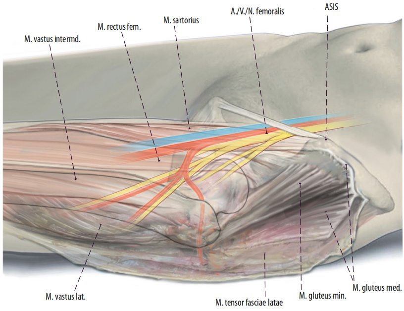 图文并茂：股骨翻修手术中的直接前入路（DAA）技术详解