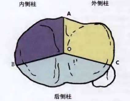 胫骨平台骨折的分型、治疗与入路选择