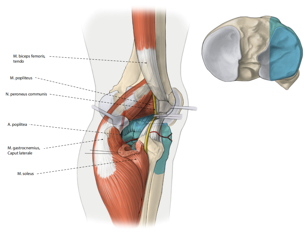 胫骨平台骨折的分型、治疗与入路选择