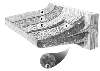 全面掌握盘状半月板的概念及损伤后该如何处理