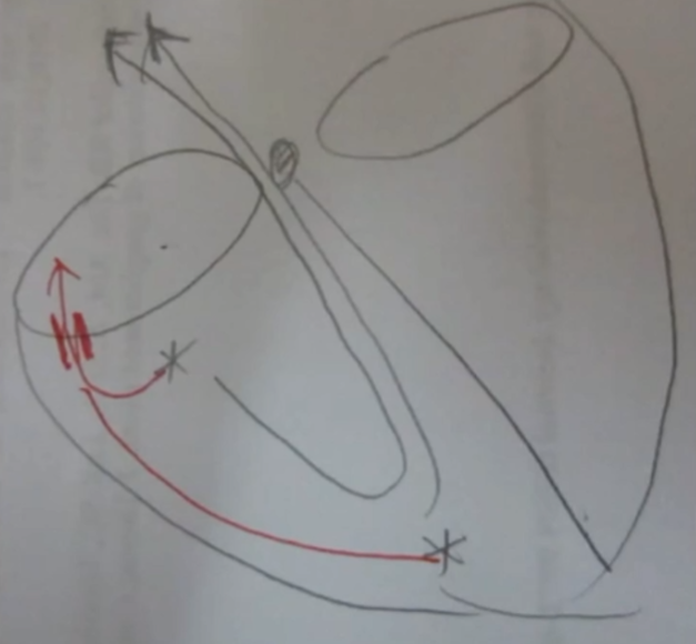 心律解码丨室上性心动过速诊断与治疗，一文详解！