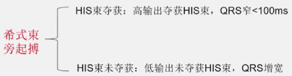 心律解码丨室上性心动过速诊断与治疗，一文详解！