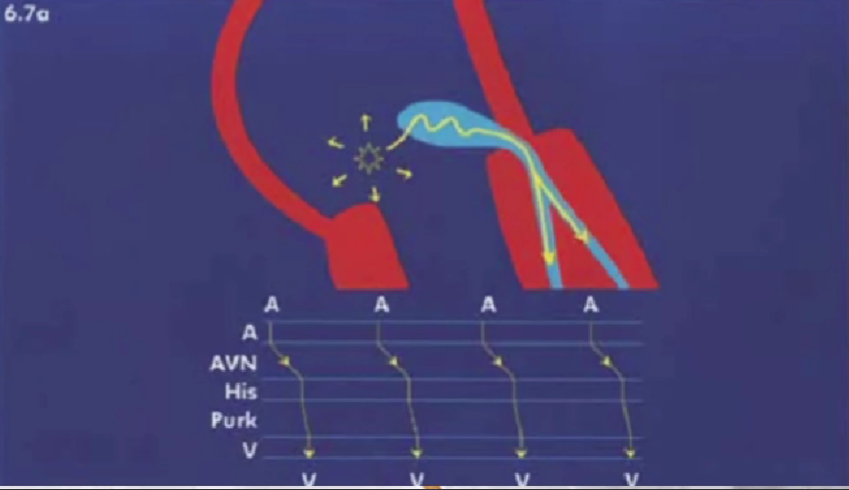心律解码丨室上性心动过速诊断与治疗，一文详解！