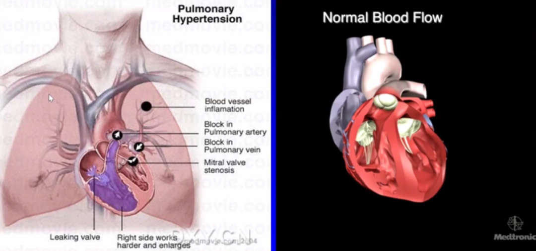 心律失常的诊断与治疗，太全了