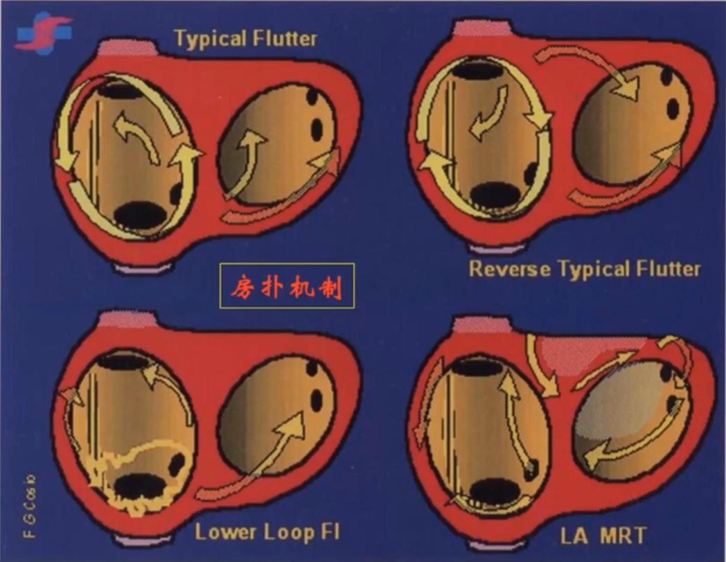 心律失常的诊断与治疗，太全了