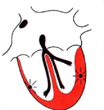 心律失常的诊断与治疗，太全了