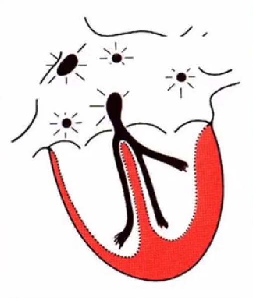 心律失常的诊断与治疗，太全了