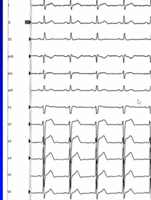 心律失常的诊断与治疗，太全了
