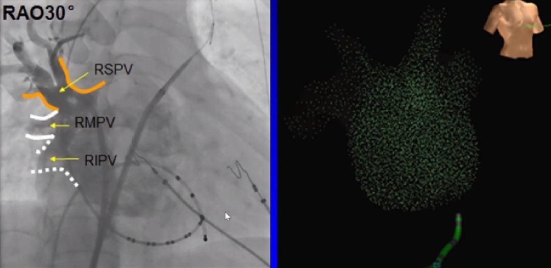 心律失常的诊断与治疗，太全了
