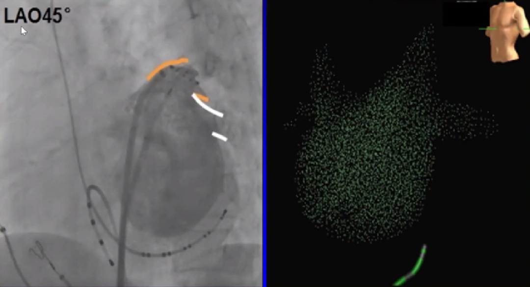 心律失常的诊断与治疗，太全了