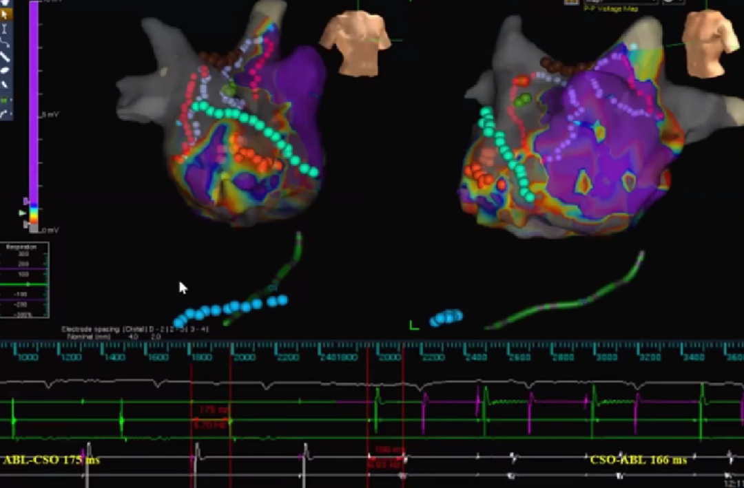 心律失常的诊断与治疗，太全了