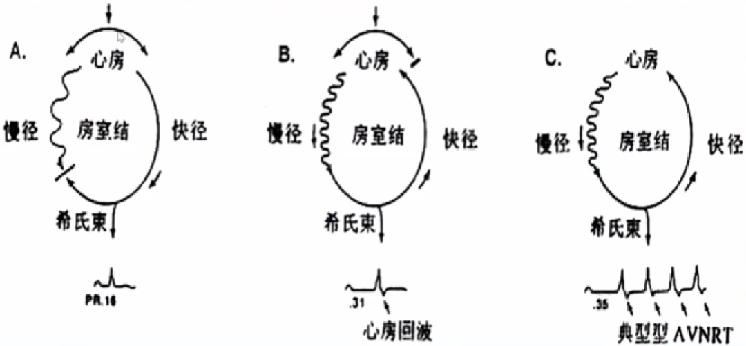 心律失常的诊断与治疗，太全了