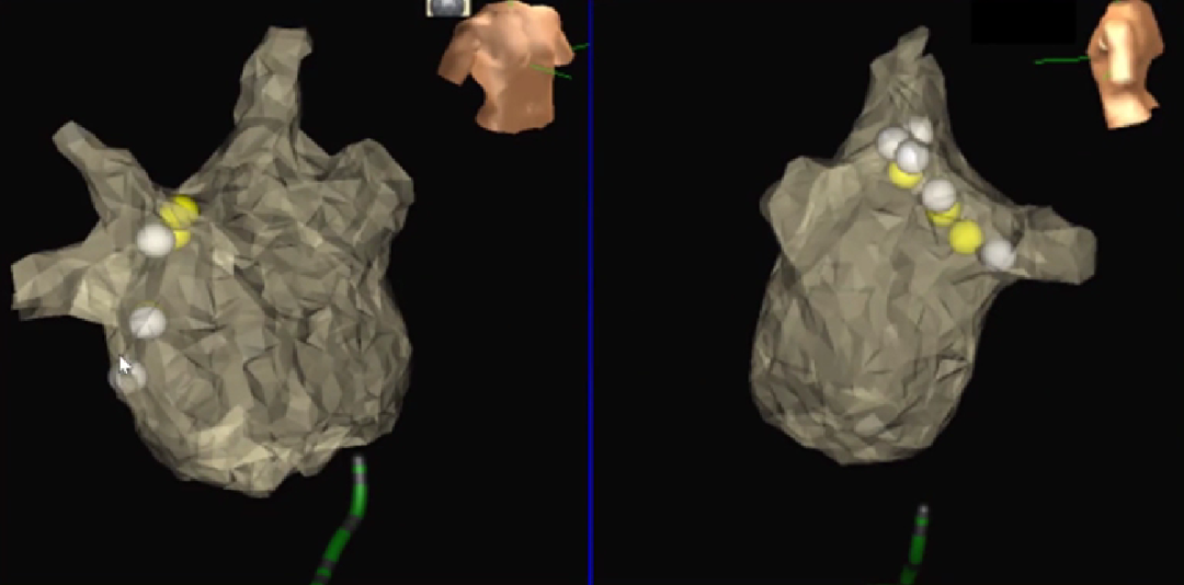 心律失常的诊断与治疗，太全了