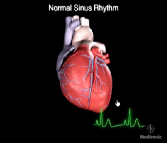 心律失常的诊断与治疗，太全了