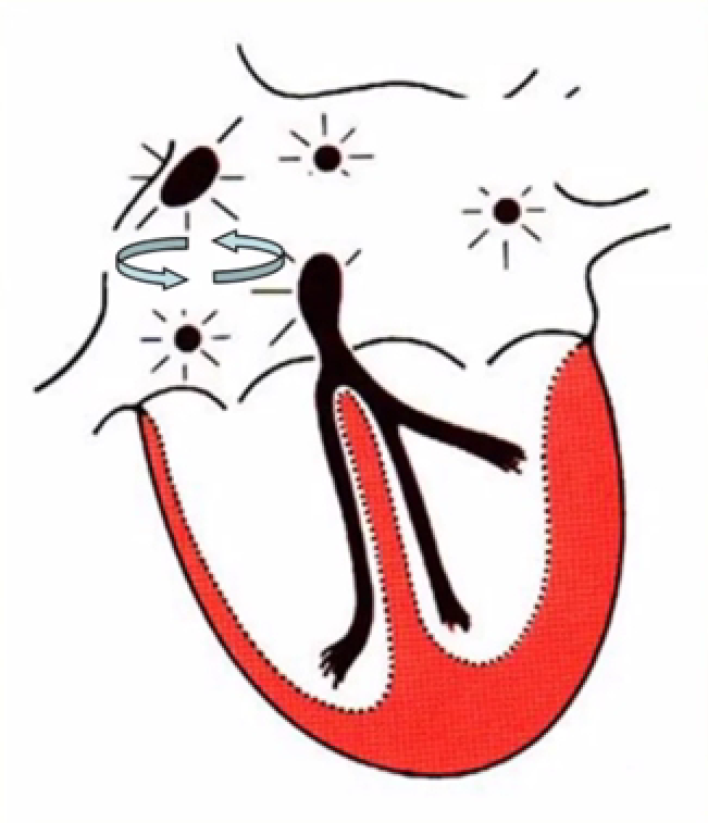 心律失常的诊断与治疗，太全了