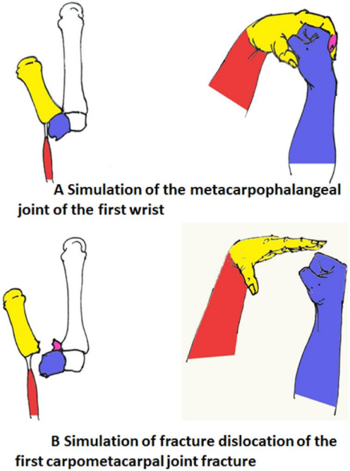 “手足并用”教学法，助你快速掌握常见（脊柱、上肢、下肢）骨折脱位及分类