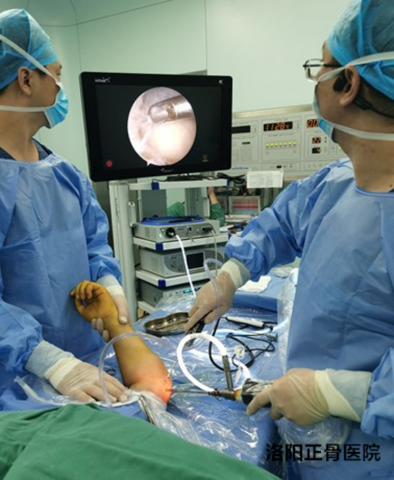 肘关节镜下“精准清理”治疗顽固性肱骨内上髁炎