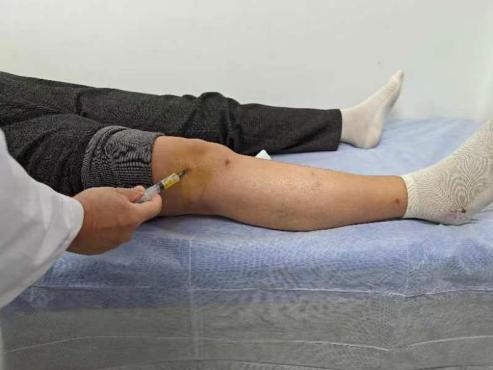 局部注射必看！骨关节运动医学关节腔注射的常用药物及注意事项