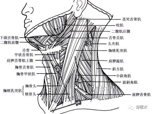 颈丛C1-4图片