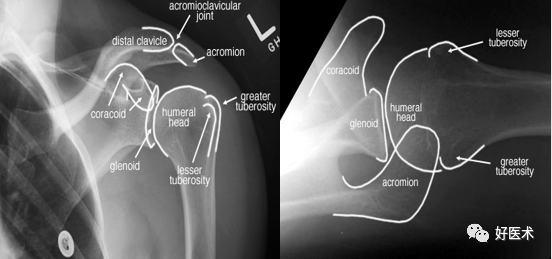 高清影像图解肩关节解剖及诊断
