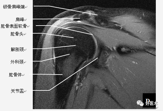 高清影像图解肩关节解剖及诊断