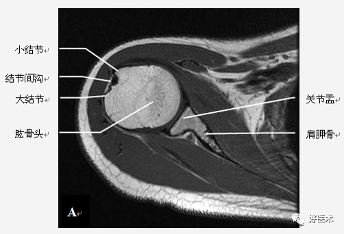 高清影像图解肩关节解剖及诊断