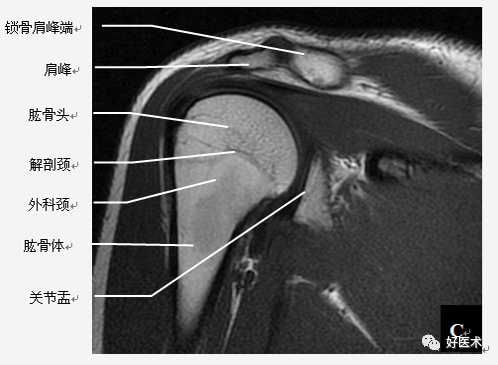 高清影像图解肩关节解剖及诊断